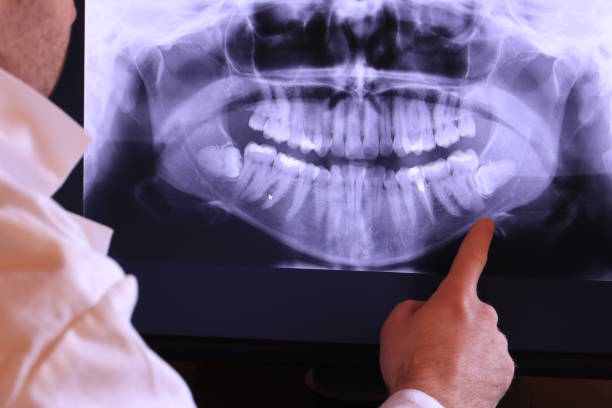 Best After-Hours Emergency Dentist in Cana, VA